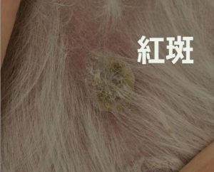 紅斑
