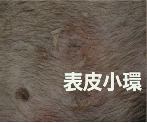 表皮小環